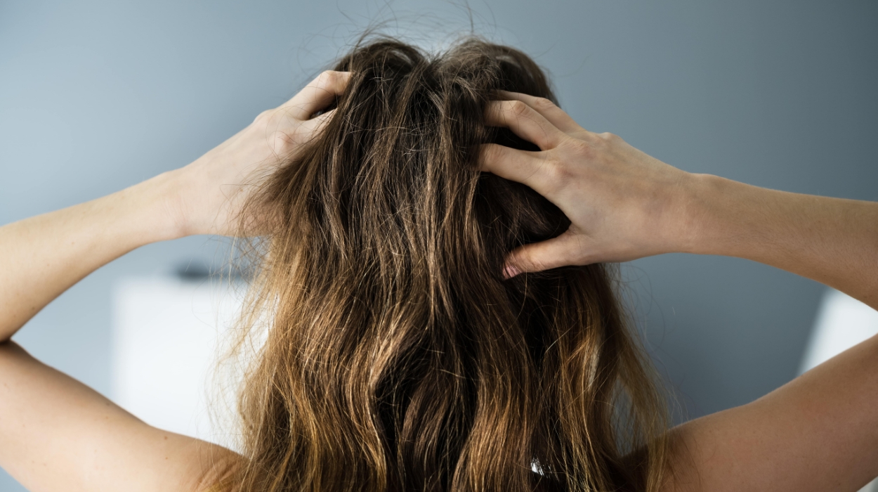 Does Dandruff Cause Hair Loss: Dry Scalp