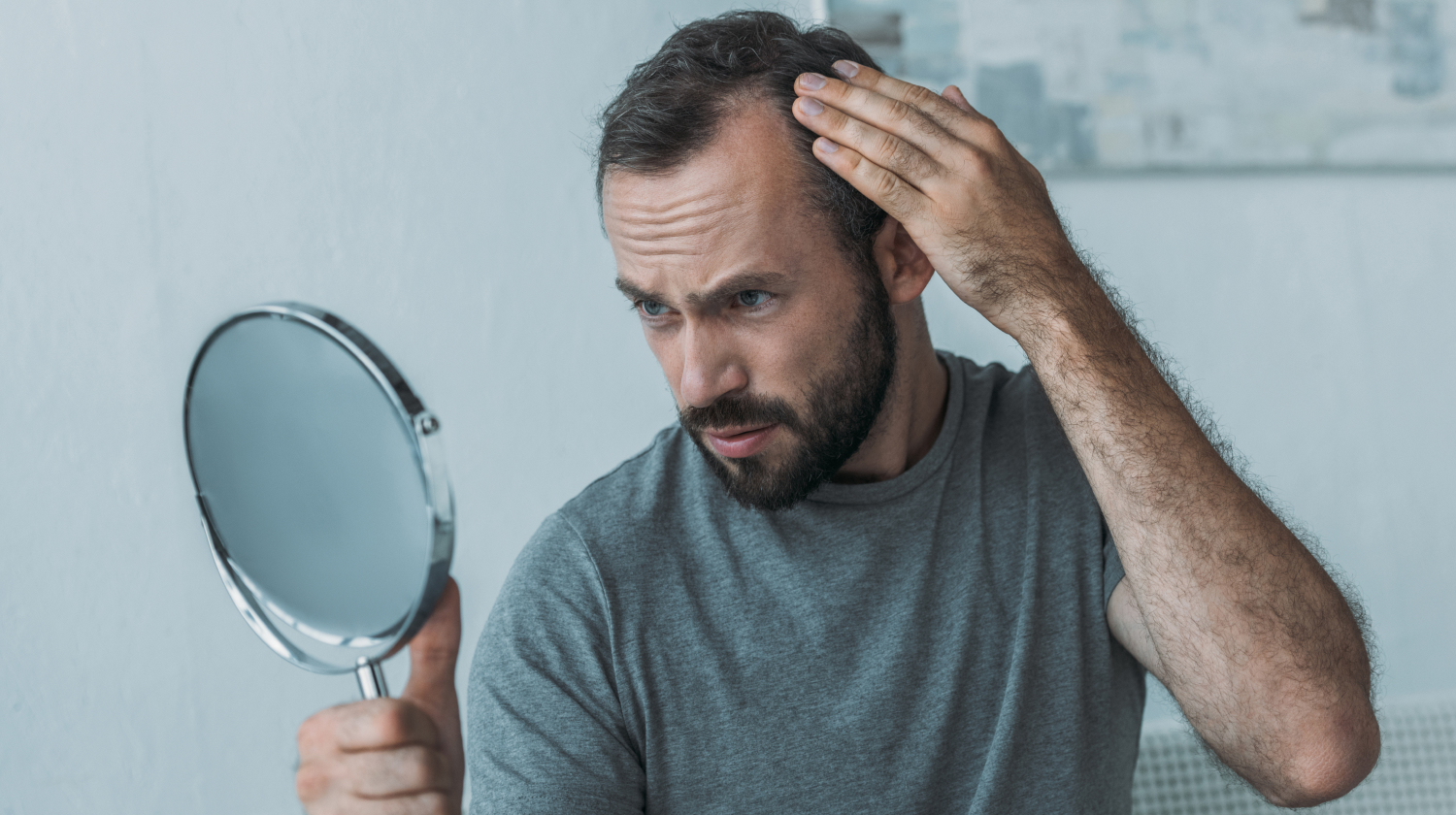 does testosterone cause hair loss