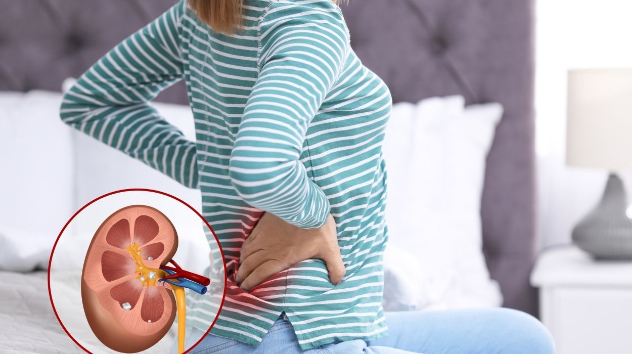 Why Does Keto Cause Kidney Stones