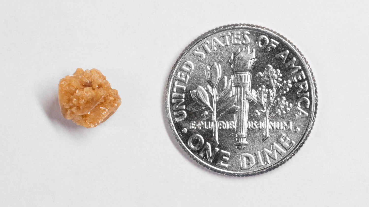 what size kidney stone requires surgery
