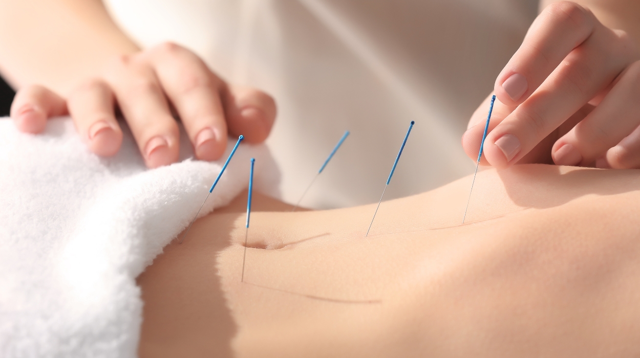 Acupuncture Benefits For Weight Loss 