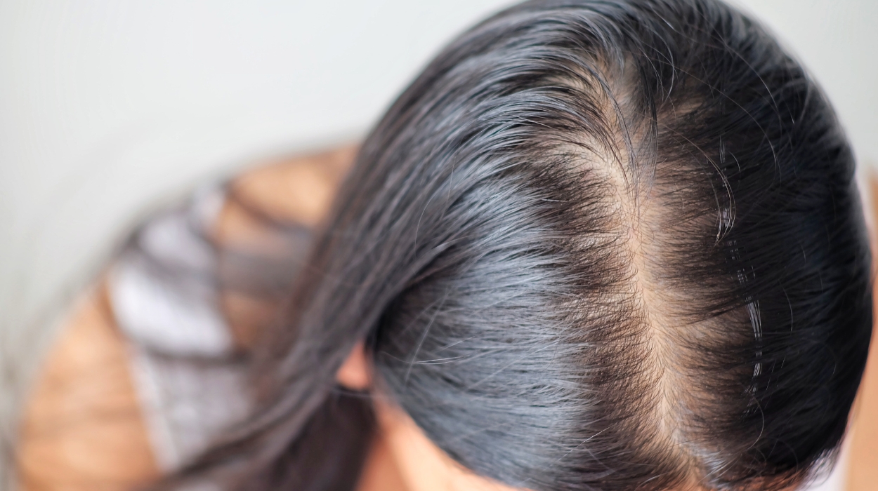 What Is Hair Breakage At Crown